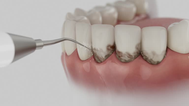 Trusted Teeth Cleaning And Checkup service in Catlin, IL - Dentist Open Now